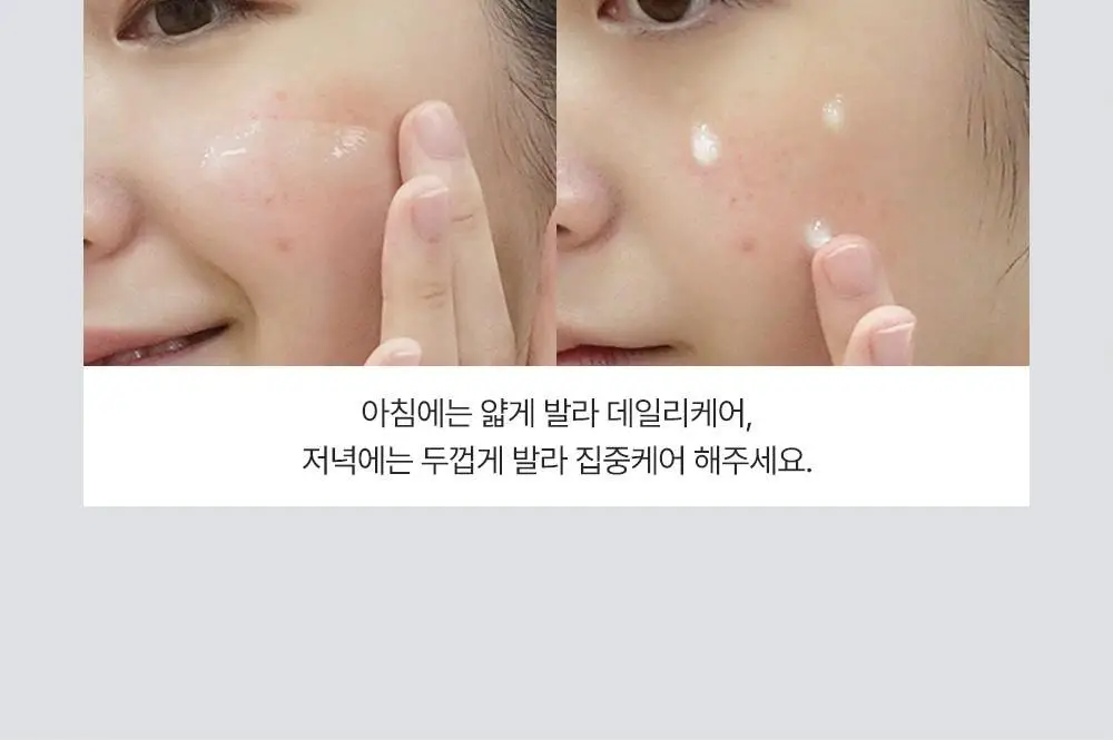 [트러블부위 진정케어] 피캄 센텔라 트러블 스팟 15ml 상세페이지 31
